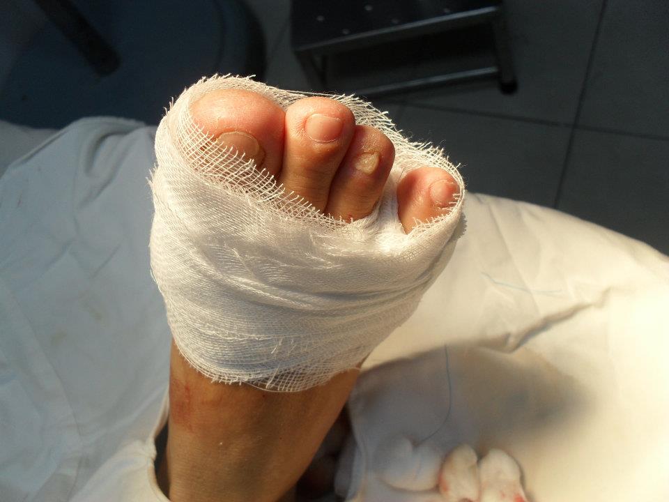 Quy trình thay băng vết thương theo bộ y tế - hướng dẫn chi tiết và cập nhật mới nhất